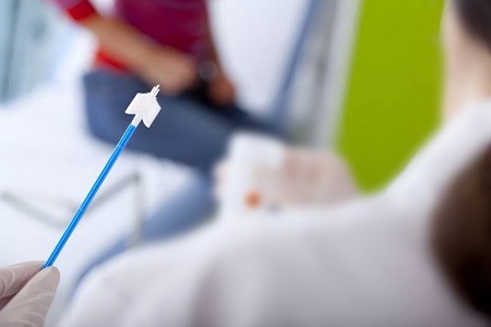 Dul Chun Cinn i Scagadh Ailse Ceirbheacs: Ról na dtástálacha HPV féin-bhailiúcháin