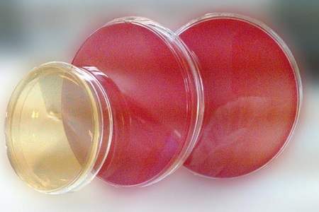 Salmonella Shigella agar (SS): An meán riachtanach le haghaidh aonrú pataigine