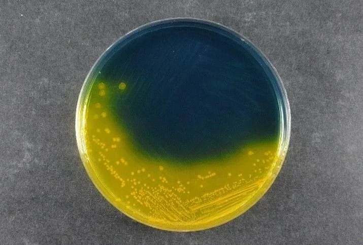 Sábháilteacht bia a chinntiú: Tacaíonn Salmonella Shigella Agar (SS) Babio le Caighdeáin Braite Pataigine Domhanda