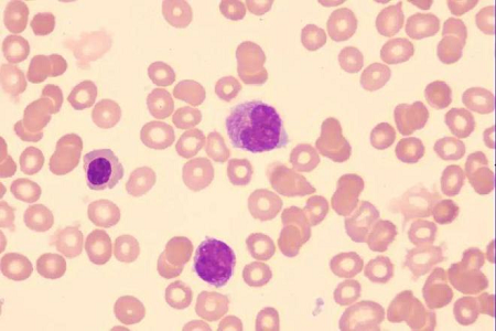 Seolann Babio réiteach ardcháilíochta Giemsa stain do shaotharlanna domhanda
