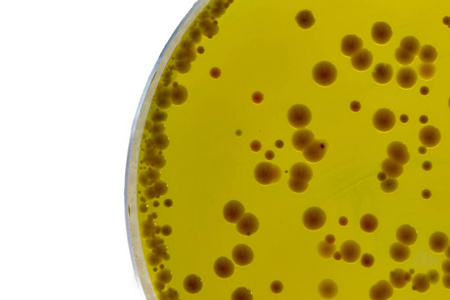 Seolann Babio bonn agar ardcháilíochta ar ardchaighdeán le haghaidh tástála iontaofa Staphylococci