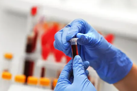 Brath Mear Maláire: Cumhachtaíonn Trealamh Tástála Dé Antaigin BABIO Sláinte Dhomhanda